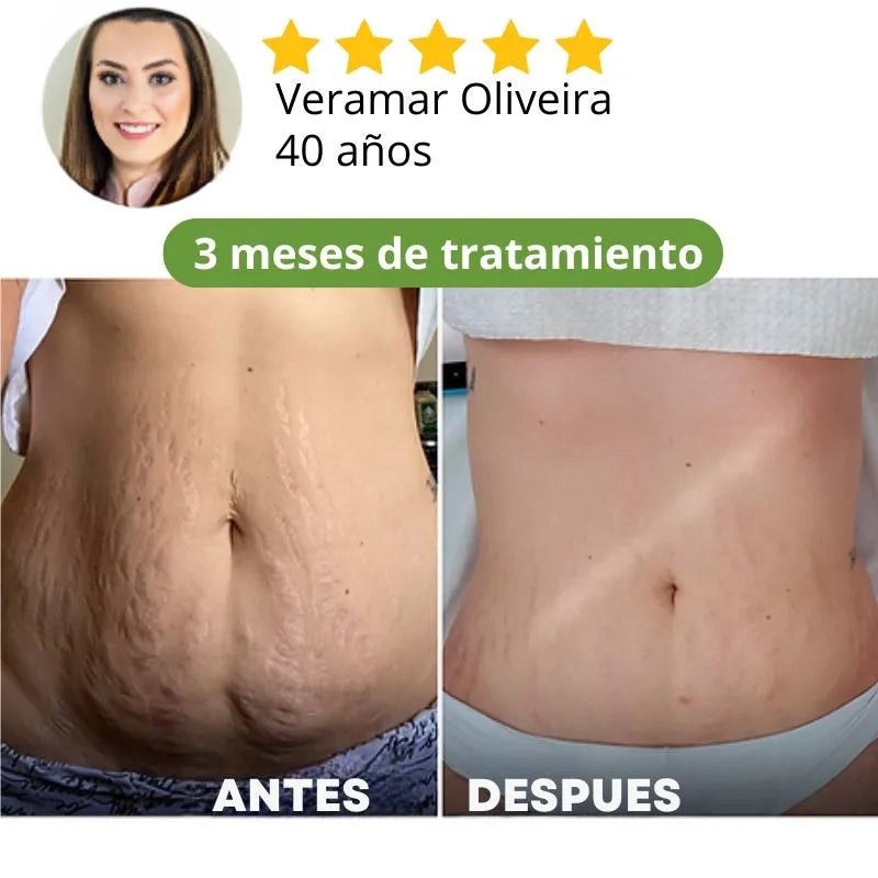 Descubra ahora Crema reafirmante que há ayudado más de 30mil Mujeres a transformar su autoestima!