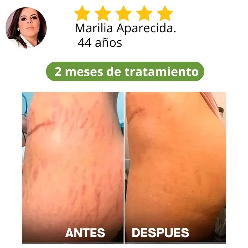 Descubra ahora Crema reafirmante que há ayudado más de 30mil Mujeres a transformar su autoestima!