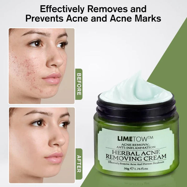 LIMETOW™ Crema herbaria para eliminar el acné y manchas de la piel